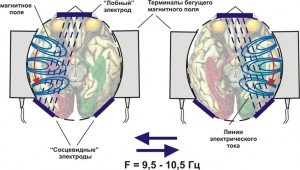 Электростимуляция мозга цена в Киеве