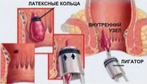 Ауробин