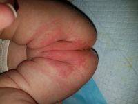 Онлайн консультация педиатра